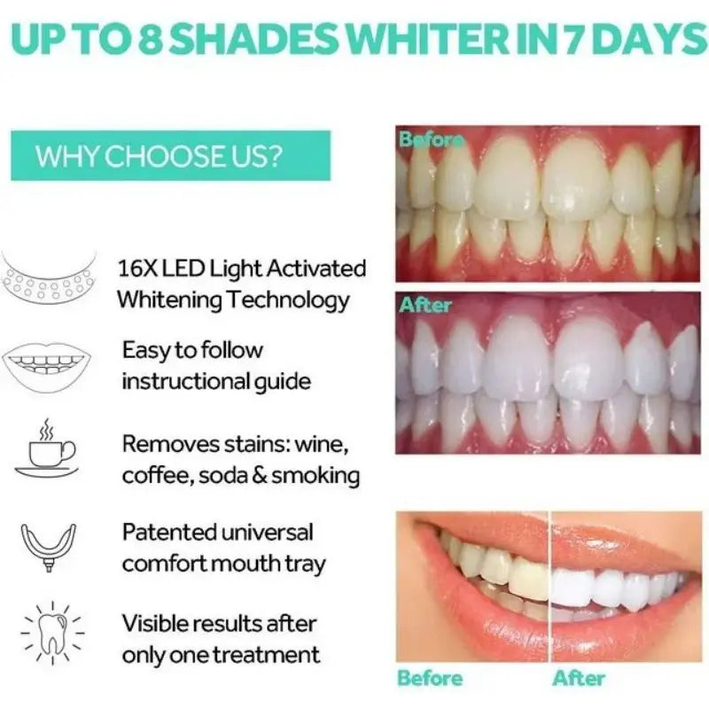 Przenośna Lampa Akcelerator do Białych Zębów